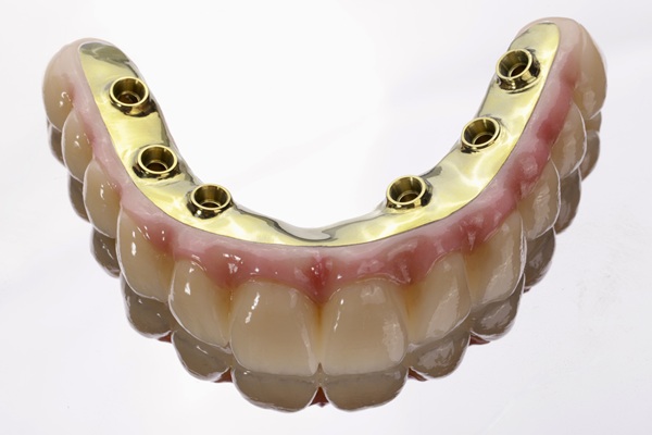 Implant Supported Dentures: What They Are And How They Work